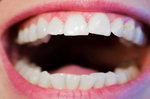 不用砸大錢也能美白牙齒！7種在家就能做的天然療法，從此告別羞人的大黃牙！