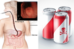 傷腎、害腦「可樂」喝下肚的「十種變化」，喝【零卡可樂】比全糖更毒？｜每日健康Health