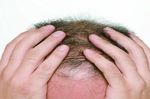 【男性必看】掉髮不是病？這幾種落髮其實是「身體警訊」，別再忽略了！｜每日健康Health