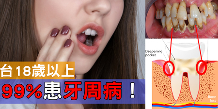 台灣人「牙周病」率世界第一，失智、肺炎跟著來！這樣刷牙才能「徹底殺菌」｜每日健康Health