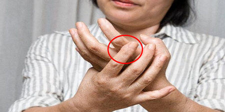 「第二指節」浮腫，當心「風濕」前兆，把握黃金治療期「２０.４個月」
