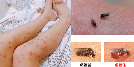 被「小黑蚊」叮會引發「蜂窩性組織炎」？專家警告：這些人體溫高最易被咬｜每日健康Health