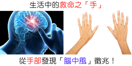 「手麻」、「關節疼痛」，原來從「手」就可以看出腦中風？【３大保命秘訣】就靠它｜每日健康Health