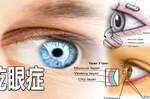 眼睛時常乾澀甚至視線模糊？「乾眼症」一但發作無法根治，出現這七大症狀千萬注意！