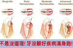 全台灣90%人患有牙周病！牙關咬緊！口腔問題不處理，全身疾病通通來！｜每日健康 Health