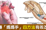 「媽媽手」一發作，「手指僵硬、輕微轉動」都會痛？根治「腱鞘炎」只需四步驟，解除疼痛不求人｜每日健康Health