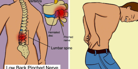 你常常背痛、腿痛嗎？這些跡象小心是「腰椎間盤突出」！如不及時治療，可造成永久性的神經損傷！