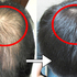 頭頂「禿一塊」好尷尬,解救你的落髮危機,健髮【四吃四不吃】讓你的萎縮毛囊起死回生!|每日健康Health