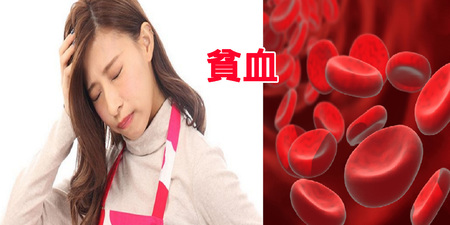 台灣60%女性患有「貧血」！5類食物是「鐵質殺手」最好別碰，越吃越嚴重｜每日健康Health