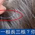 白髮拔一根長三根?醫師踢爆六大白髮謠言,拒當「灰」姑娘千萬別做這兩件事!