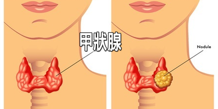 「甲狀腺」異常這樣吃更危險？影響甲狀腺的食物真相，預防激素失控的根本之道。