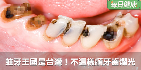 台灣竟是蛀牙王國！再不這樣顧牙齒就爛光光啦｜每日健康 Health