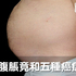 人人都該知道!腹脹難消竟是大病警訊?當心肝病、五種癌症已悄悄上門|每日健康 Health