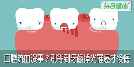 牙齦流血、嘴裡白斑小事一樁？5大口腔問題忽視了罹癌率飆高30% ｜每日健康 Health