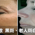 還在花錢買保養品?5種你不知道的天然美白藥,這樣用擊退陳年斑點,不上妝也美!|每日健康 Health