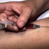 80%病人死於「化療」而非癌症?日醫這樣說|每日健康 Health