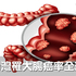 恐怖!大腸癌年奪5000命,快吃6大護腸美食補滿防癌力,從此和腸癌斷絕關係|每日健康 Health