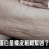 橘皮組織竟是吃出來的!口服膠原蛋白不可超過這個量,2招讓大腿、臀部滑又嫩|每日健康 Health