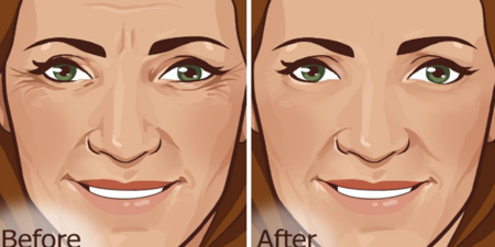 一條皺紋老十歲，你也感到困擾嗎？「6個自然療法」橫掃臉上皺紋！皮膚超光滑。