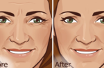 一條皺紋老十歲，你也感到困擾嗎？「6個自然療法」橫掃臉上皺紋！皮膚超光滑。