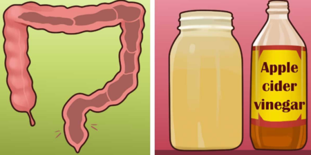 腸道乾淨，人自然就健康。每天早上一杯「蘋果醋」排出毒素！還可改善疲勞、頭痛。