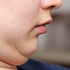 30歲了還嬰兒肥?醫生教你4步驟輕鬆去掉臉上兩坨肉,瓜子臉美人就是妳|每日健康 Health