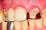 40年老牙醫的告白！台灣牙周病率世界第一都要怪自己，不戒5大NG害牙行為，難怪滿口發黃有牙垢｜每日健康 Health