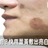 黑斑冒出頭瞬間變大媽!快用薑黃進行逆齡敷法,隔天起床就有一張亮白青春水臉|每日健康 Health
