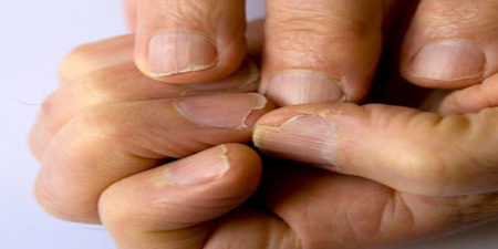 不可不學的「天然浸泡法」！拯救脆弱易斷的指甲！還你一雙纖纖玉手！