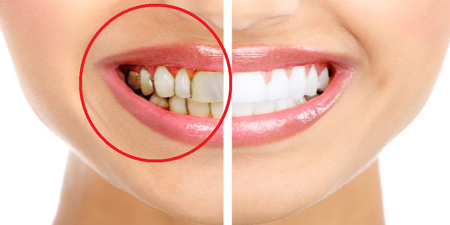 刷牙發現牙齦出血？「牙齦炎」恐惡化成「牙周病」！8種護牙密技，讓你重拾自信笑容。