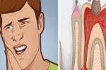 「牙痛」不是病，痛起來真的要人命！學會「5個居家妙招」，舒緩疼痛不求人。