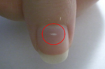 你的指甲上也有「小白點」嗎？指甲出現「兩種情況」應就醫，當心是潛在疾病的徵兆。