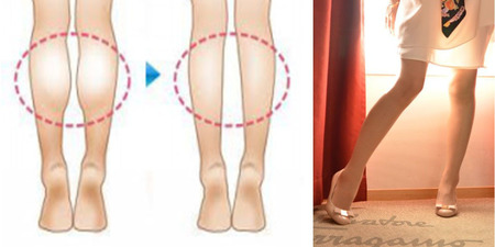 您知道腿型也能看出身體出什麼毛病嗎？不論是「Ｏ形腿」、「水腫腳」、「扁平足」都表示身體這些地方有問題！