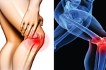 「膝關節疼痛」年齡層逐漸下降，全台約有350萬人為之所苦！膝關節保護「蓋」重要！