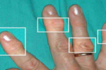 「關節炎」嚴重可導致手指變形，不可輕忽！7種自然療法有效緩解，疼痛、變形遠離你。
