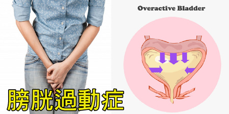 台灣約有400萬人「膀胱過動」，廁所跑不停！攝取「5種天然補品」，讓膀胱不再亮紅燈。