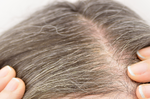 白髮並非老化，而是「酪胺酸」太少！博士：找回烏黑秀髮先戒８惡習｜每日健康 Health