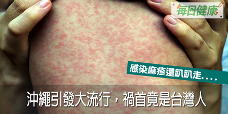 得麻疹還不隔離，台灣男害「沖繩」大流行