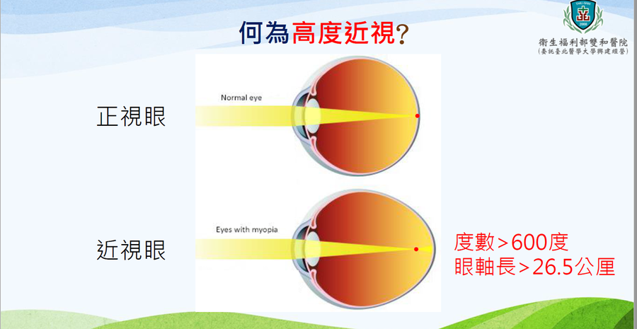 600度近视不治疗,医师警告:10年后视力只剩下「0.1」
