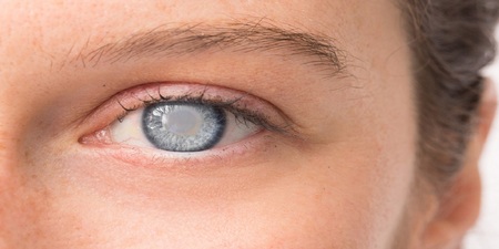 「青光眼」視力受損不可逆　醫：10大高危險群應定期檢查｜每日健康Health