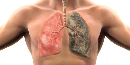 肺癌發病率從45歲開始快速攀升　不想罹癌就要做對一件事｜每日健康 Health