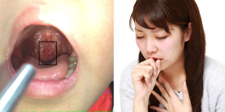 喉嚨底部出現「這個」恐是鼻涕倒流徵兆　醫師：這種咳嗽很難好