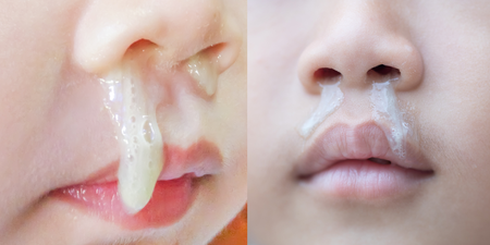什麼顏色的鼻涕最糟糕？黃鼻涕就是鼻竇炎？兒科權威一次解答