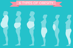 水腫肥胖要多吃；脂肪肥胖要忌口！掌握減重3大原則，體質不同照樣很好瘦