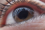 青光眼早期症狀難以察覺　務必遵守「3不原則」降眼壓預防退化