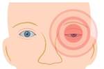 「大小眼」可能是腦中風前兆？更可能是肺癌或肺結核的關鍵病徵？
