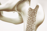 鈣片吃多會結石？高鈣飲食就能補骨？醫師澄清五大「骨鈣迷思」