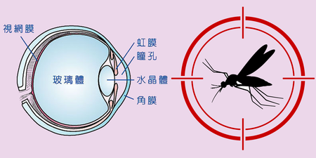 時不停有蚊子在眼前飛？你的「飛蚊症」有危險性嗎？5個方法自我檢測