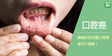 嘴巴破是癌症前兆？三週以上風險增