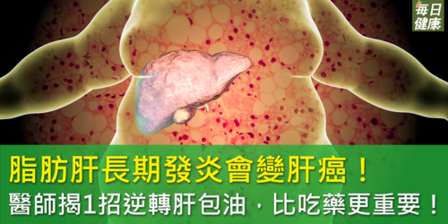 脂肪肝長期發炎變肝癌！醫師揭1招有效逆轉肝包油